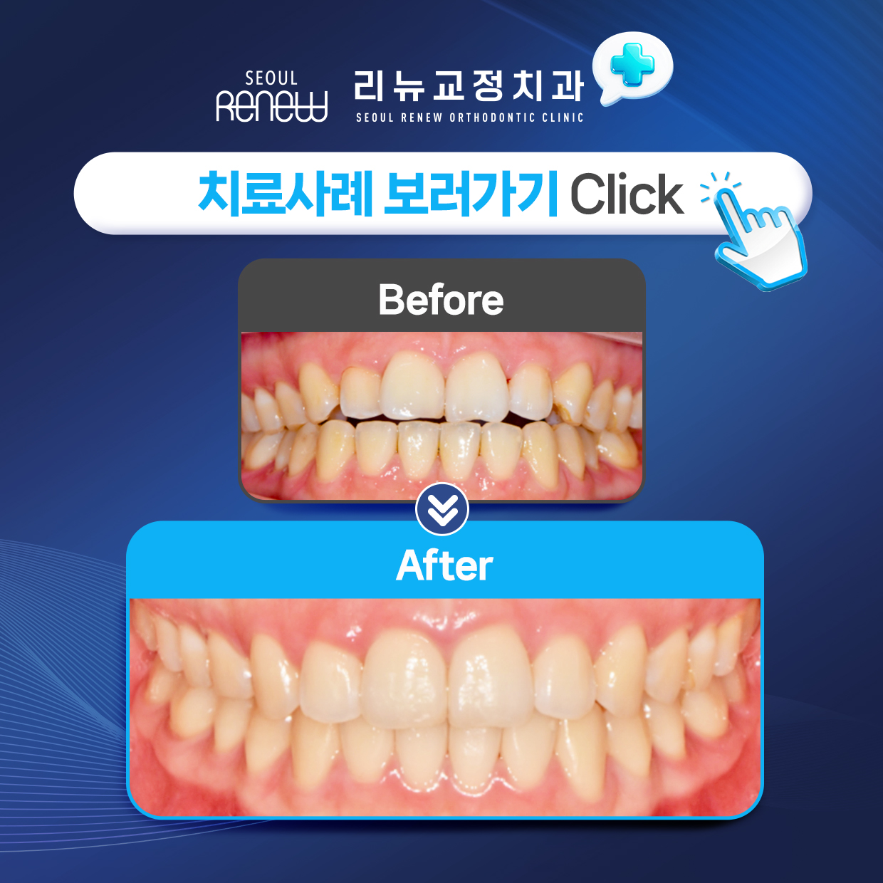 교정사례 보러가기